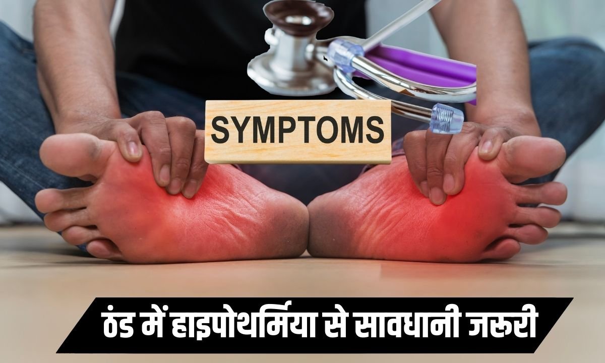 ठंड में हाइपोथर्मिया से सावधानी जरूरी