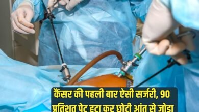 Cancer Surgery: This is the first such surgery for cancer, 90 percent of the stomach was removed and connected to the small intestine.